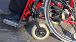 Sclerosi multipla. Identificate nuove varianti